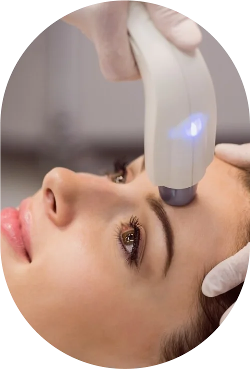 Fractional Laser