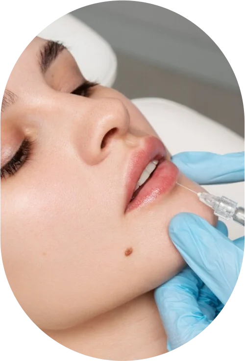 Injectable Fillers
