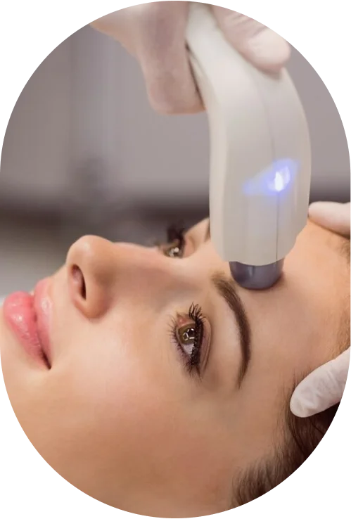 Laser Resurfacing
