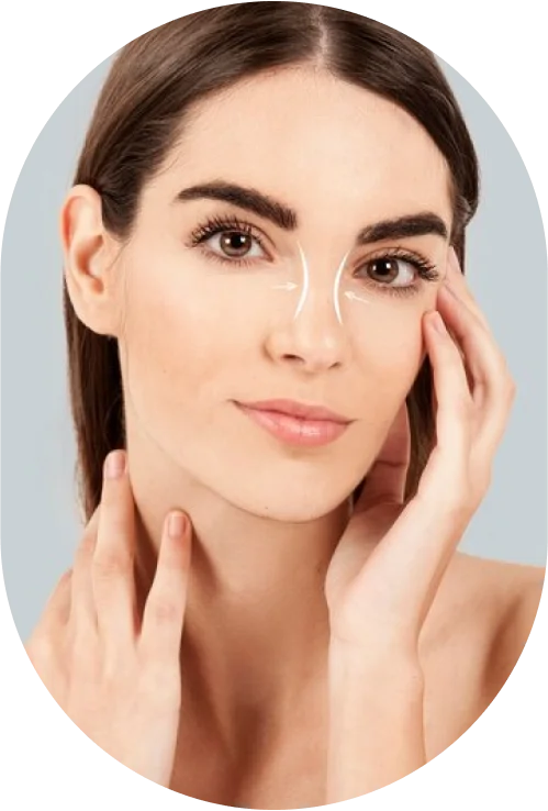 Rhinoplasty